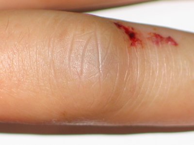 finger 2